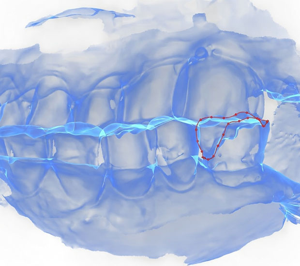 Santa Clarita Dentist