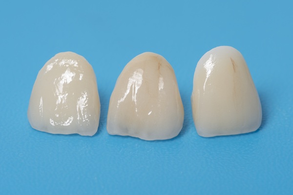 How A Ceramic Crown Can Save Your Oral Health