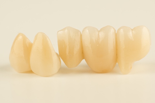 Tooth Replacement    : Why A Dentist May Recommend A Dental Bridge